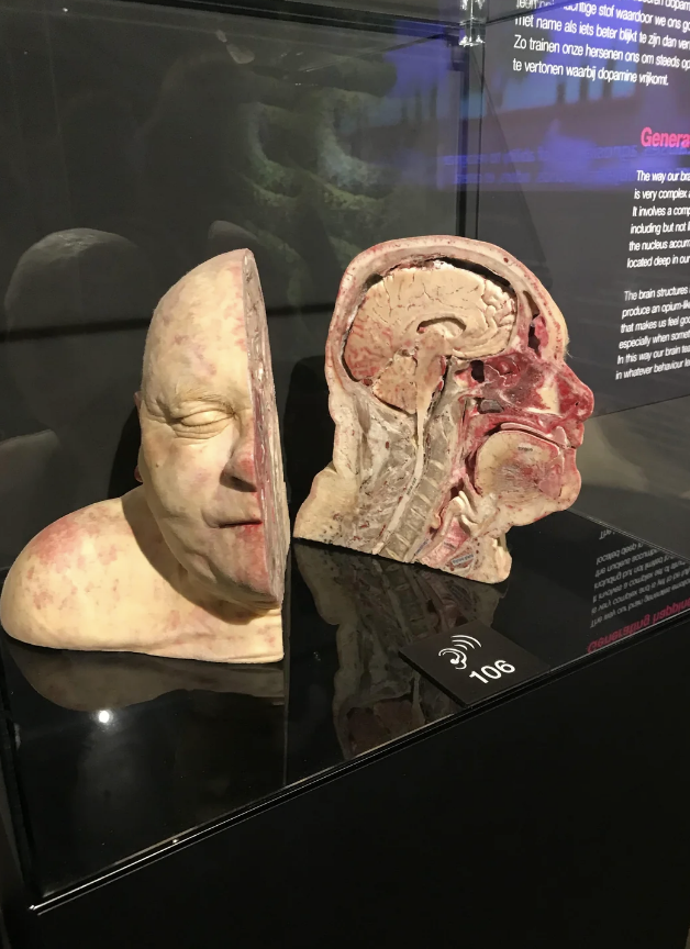 Human head anatomical cross-section display showing a face with eyes closed on one half and detailed internal structures on the other