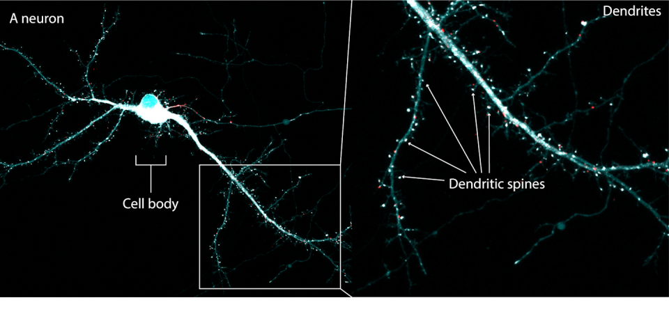 images of networked blue and white dots against a black background