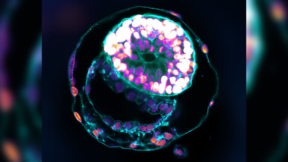 A stem-cell-based human embryo model, produced by Hanna and his colleagues, at the equivalent stage of development to day six in a natural human embryo. - Courtesy Jacob Hanna/Weizmann Institute