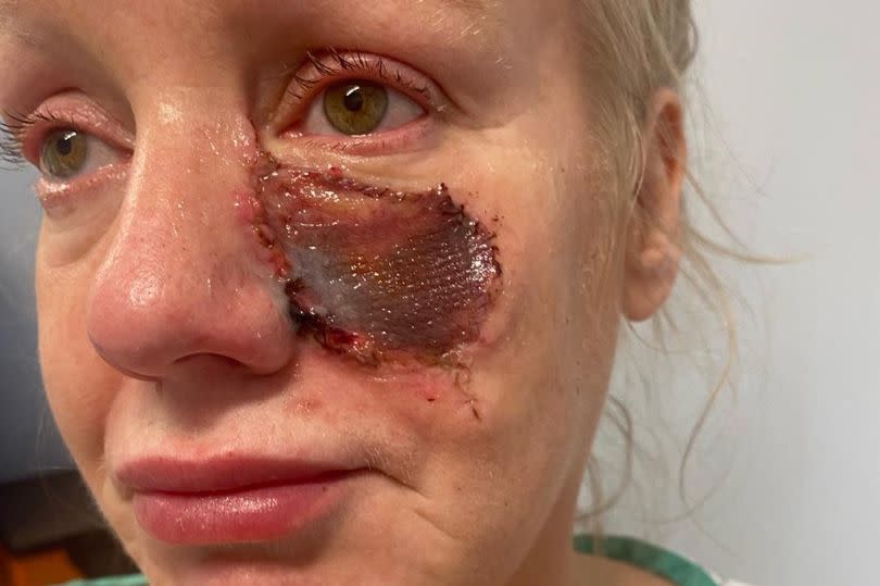 Kelly's face a week after she was attacked by a friend's sausage dog