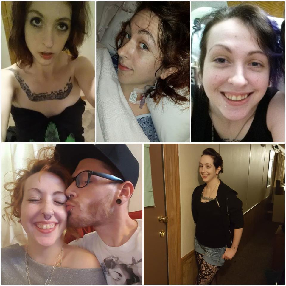 Reddit user Keri shares photos of her process of recovery from opioid addiction. (Photo: Keri Ibbotson/Reddit)