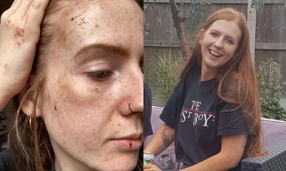 Cait Smith, 23, was attacked while jogging in Essex. (SWNS)