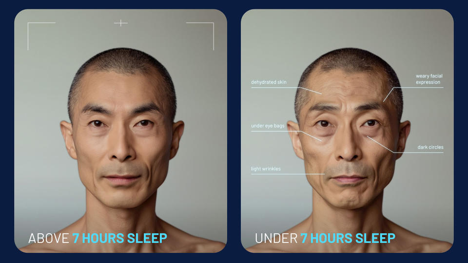 Two AI-generated images showing how a person looks after seven hours sleep (left) and how the same person looks after getting less than seven hours sleep (right)