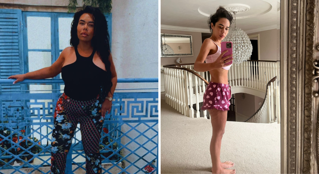 Leah Lazarus, 39, says she regrets getting weight loss surgery after she dropped nearly five stone in just four months. (SWNS)