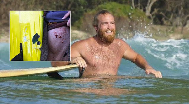 The surfer said he is lucky to be alive. Image: Supplied