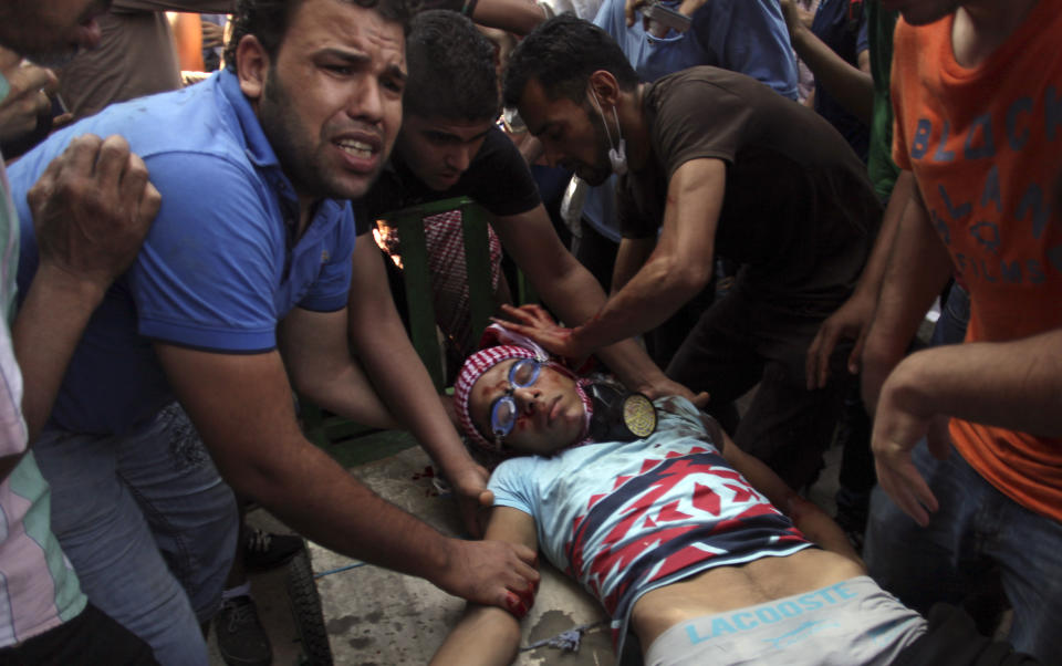 FILE - In this Aug. 16, 2013 file photo, Egyptians evacuate a wounded man during clashes between security forces and supporters of Egypt's ousted President Mohammed Morsi in Ramses Street, downtown Cairo. Civil rights and liberties around the world declined for the eighth straight year, dragged down by the Egyptian military's coup, Venezuela clinging to authoritarianism and Russia's crackdown on opposition groups, according to a pro-democracy watchdog group. (AP Photo/Khalil Hamra)