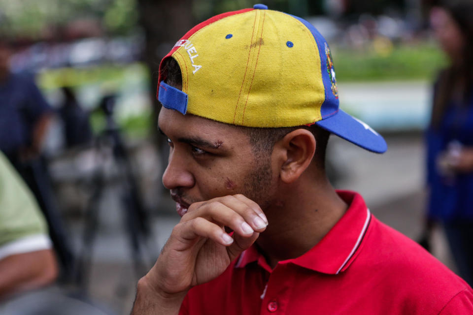 CAR302. CARACAS (VENEZUELA), 17/08/2017. El músico Wuilly Arteaga habla durante una rueda de prensa el jueves 17 de agosto de 2017, en Caracas (Venezuela). EFE/Cristian Hernández