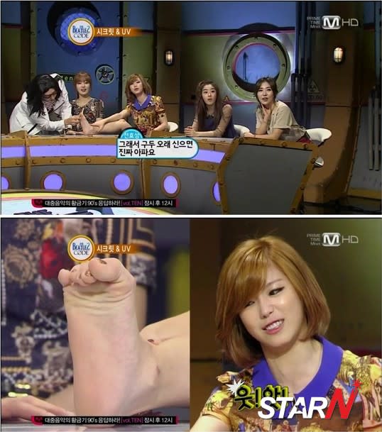 Jeon HyoSung confesses she has flat feet