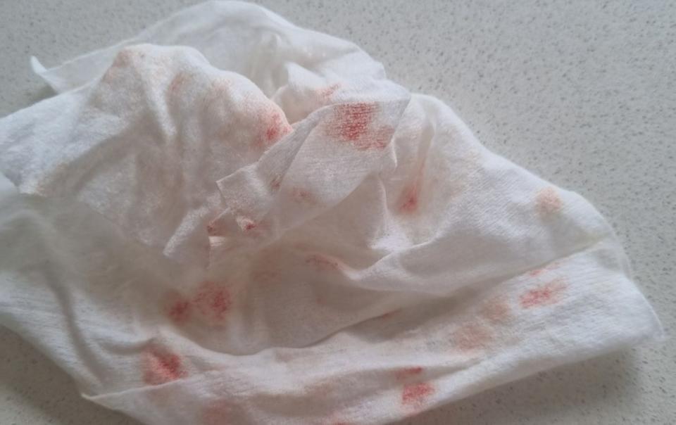 Blood-stained wet wipe from Woolworths