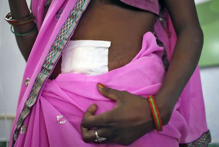 A woman, who underwent sterilization surgery at a government mass sterilisation "camp", walks to sit in a hospital bed at a district hospital in Bilaspur, in the eastern Indian state of Chhattisgarh, November 13, 2014. REUTERS/Anindito Mukherjee