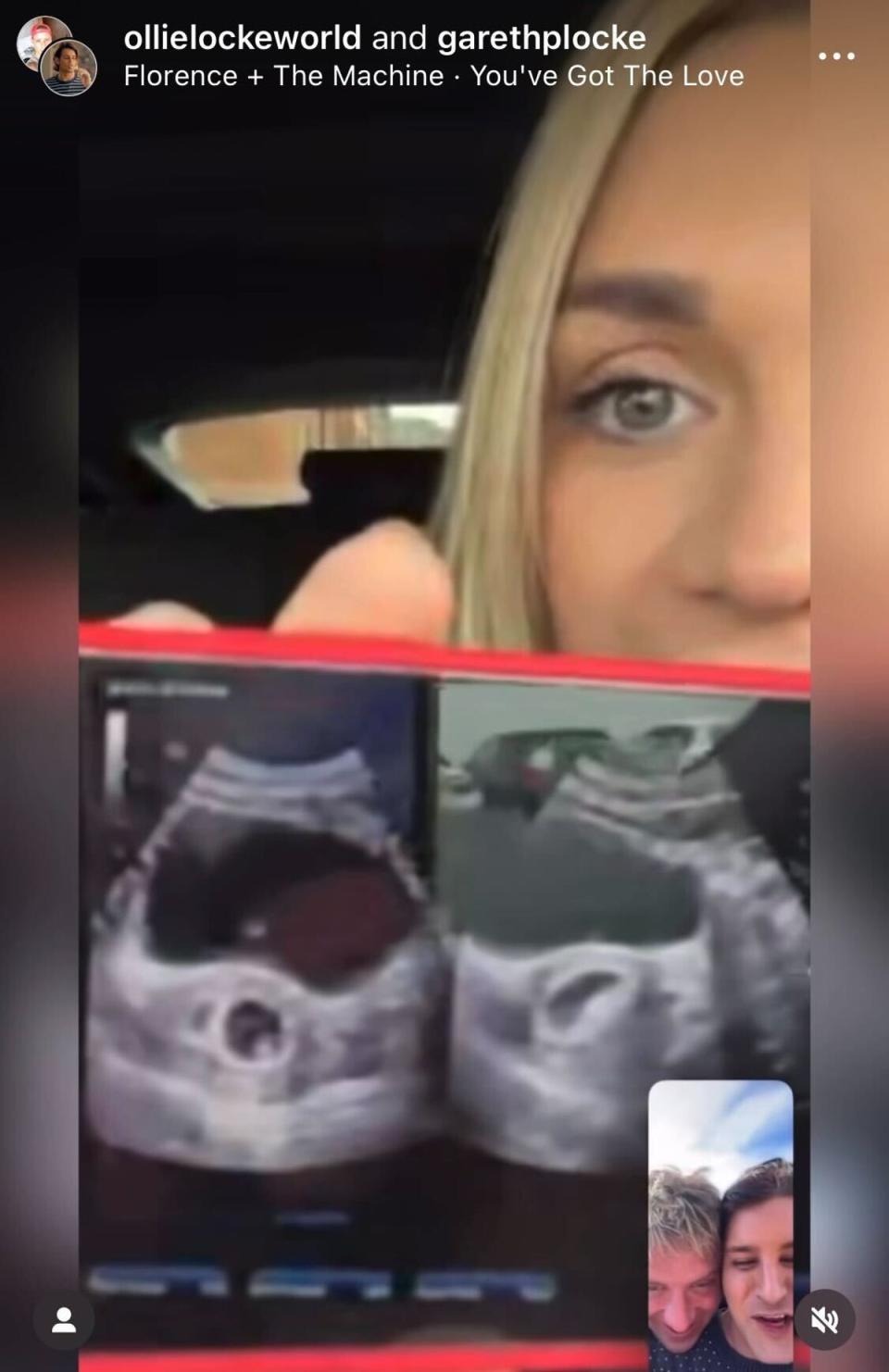 Ollie and Gareth Locke in a video call with their surrogate, Rebecca Ward, as they revealed they are expecting twins (Instagram/Ollie Locke)