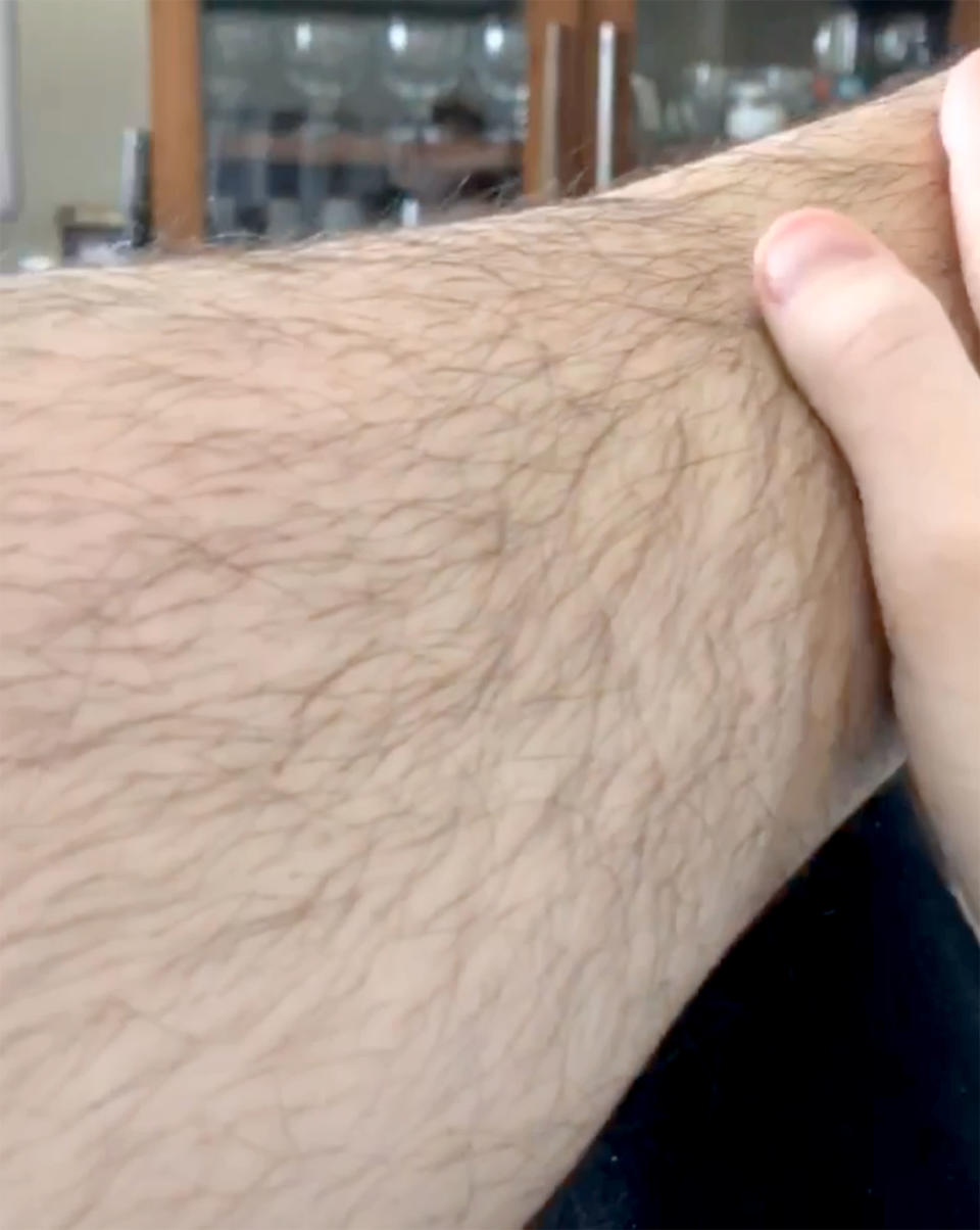 Ana shared a video of her body hair online [Photo: Caters]