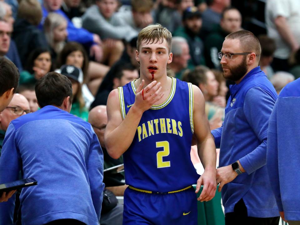 Wesley Armstead wipes away blood from his lip after taking a hit to the head during the fourth quarter of Maysville's 58-50 win against host Malvern on Tuesday night in a battle of unbeatens. Maysville improved to 10-0.