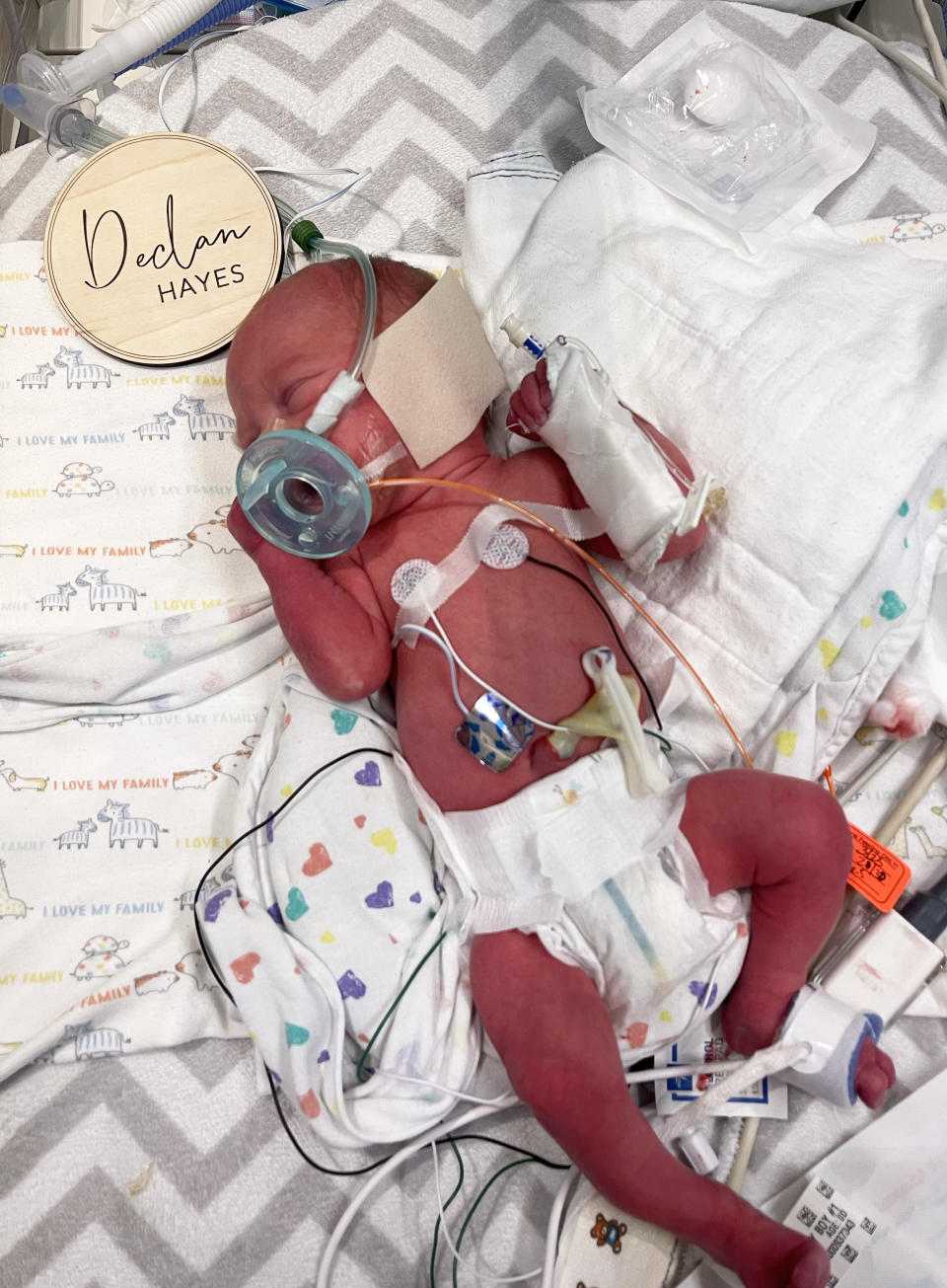 Declan, shortly after he was born premature at 32 weeks. (Courtesy Meghan Huston)