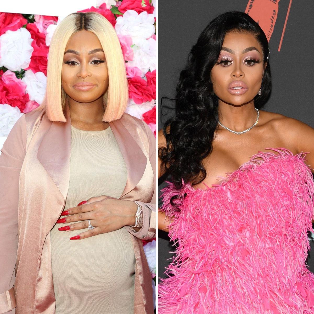 Blac Chyna’s Plastic Surgery Transformation See Photos of Her Before