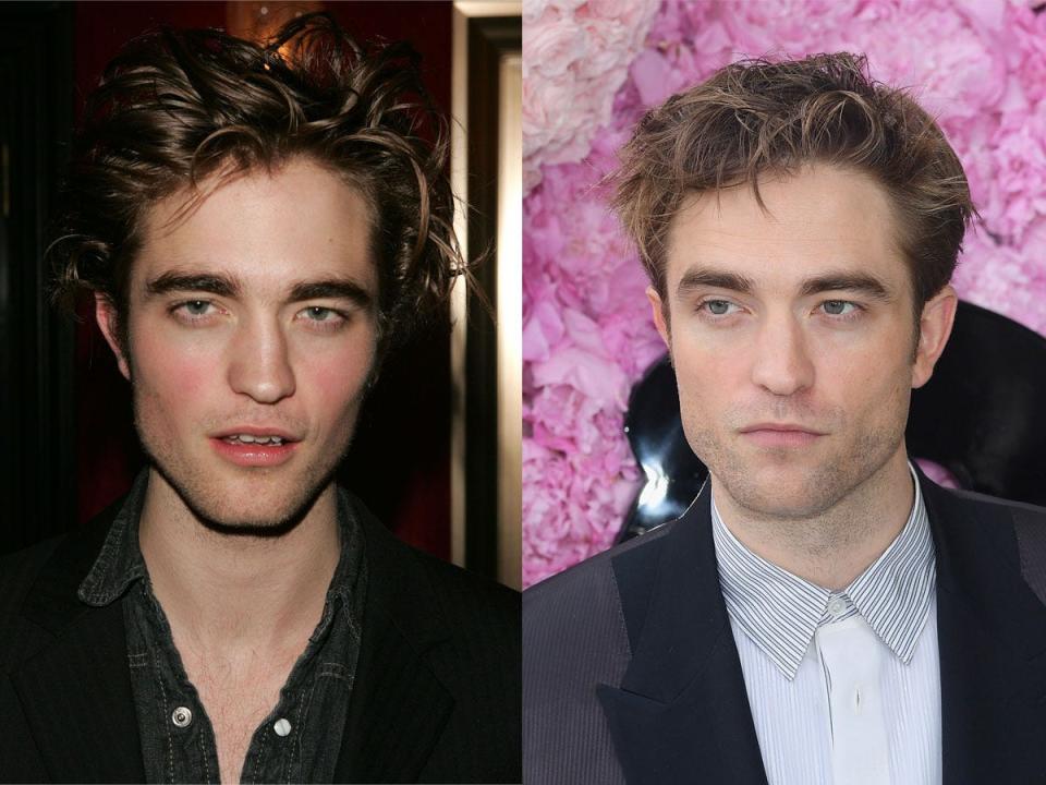 robert pattinson before after