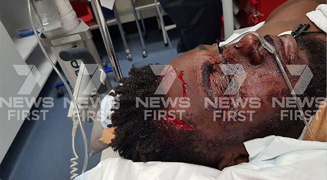 A young man is in hospital tonight after being viciously stabbed in an ambush by a woman he met online. Source: 7 News