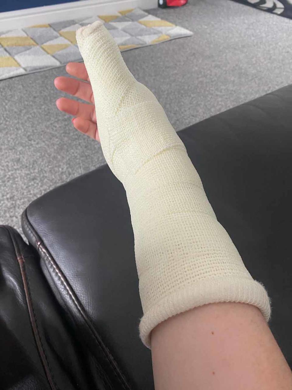 Paige’s arm in a hospital bandage. PA REAL LIFE COLLECT