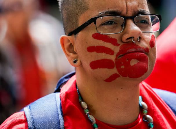 PHOTO: A marcher wears a red handprint on their face during the third annual march and gathering for Missing & Murdered Indigenous Women, People & Families, May 6, 2023, Seattle. (Lindsey Wasson/AP)