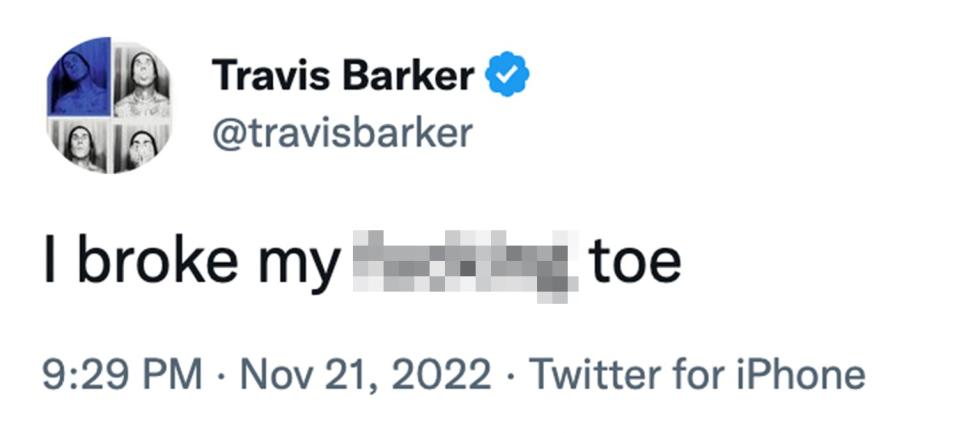 Travis Barker broken toe