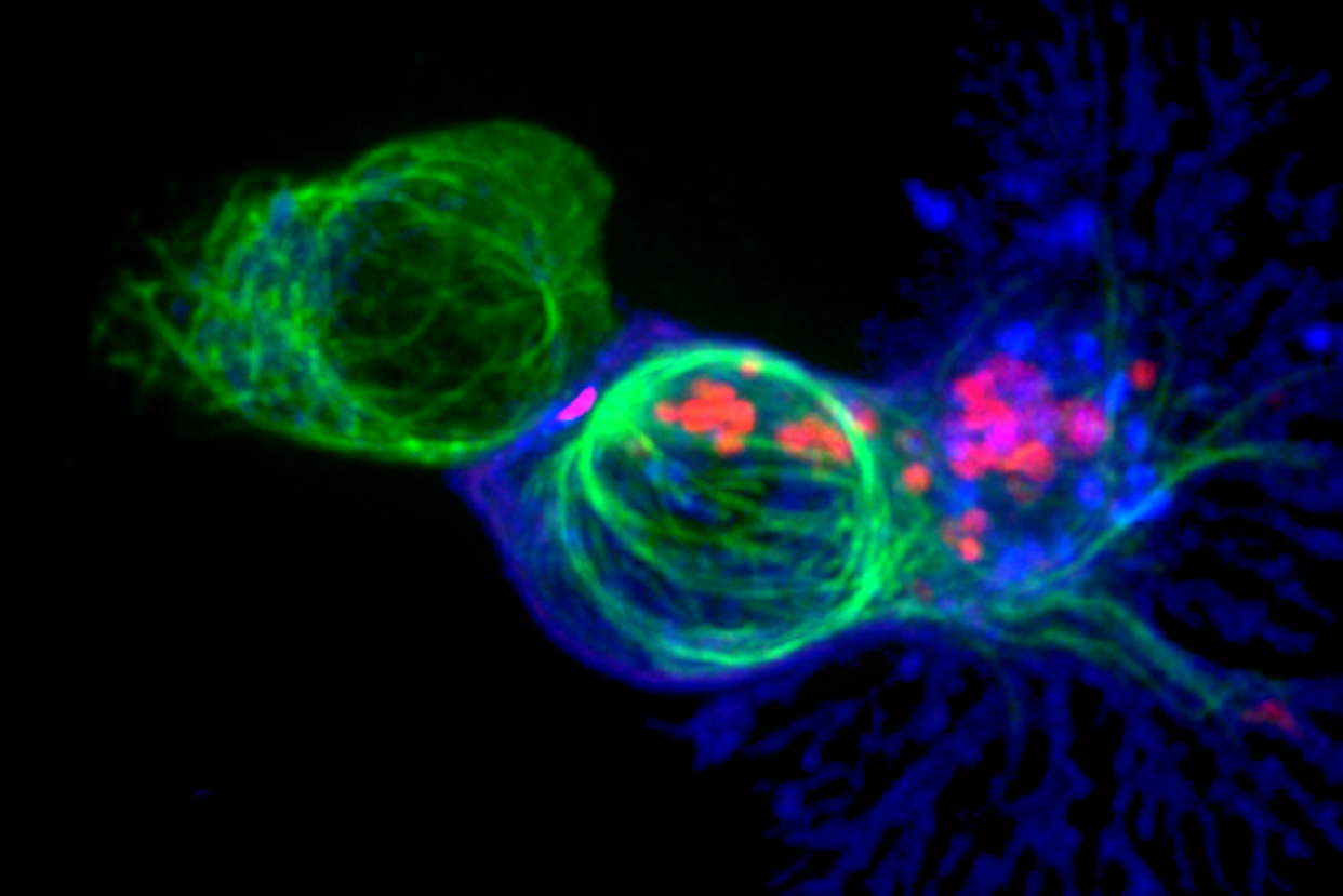 This microscopy image shows a cytotoxic T cell (blue) attacking a cancer cell (green) by releasing toxic chemicals (red). <a href="https://flic.kr/p/wyPJtV" rel="nofollow noopener" target="_blank" data-ylk="slk:Alex Ritter and Jennifer Lippincott Schwartz and Gillian Griffiths/National Institutes of Health via Flickr;elm:context_link;itc:0;sec:content-canvas" class="link ">Alex Ritter and Jennifer Lippincott Schwartz and Gillian Griffiths/National Institutes of Health via Flickr</a>