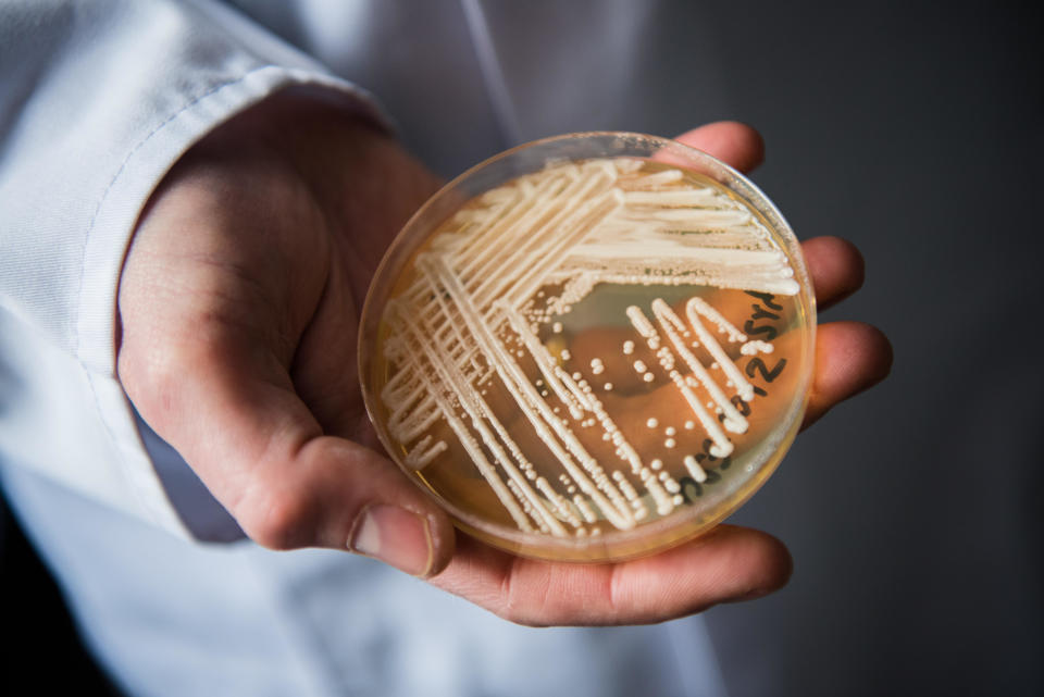 A petri dish of the yeast Candida auris, seen in a laboratory of Wuerzburg University in Wuerzburg, Germany, in a file photo from Jan. 23, 2018.  / Credit: Nicolas Armer/picture alliance via Getty Images