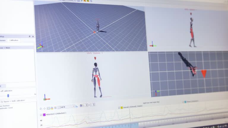 El movimiento es registrado y analizado por un sistema de inteligencia artificial que es capaz de evaluar cualquier deterioro en un paciente el doble de rápido que los mejores médicos