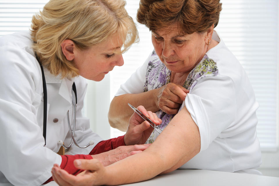 Doctor removing a tick with  tweezers from skin of patient