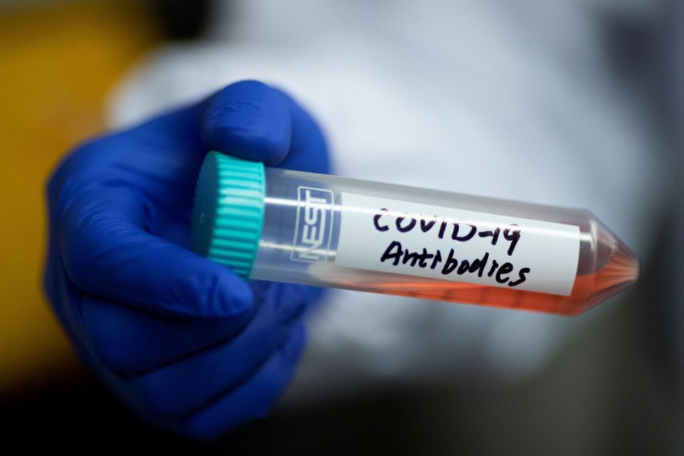 FILE PHOTO: Scientist Linqi Zhang shows a tube with a solution containing COVID-19 antibodies in his lab where he works on research into novel coronavirus disease (COVID-19) antibodies for possible use in a drug at Tsinghua University's Research Center for Public Health in Beijing, China, March 30, 2020.  REUTERS/Thomas Peter