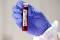 FILE PHOTO: Fake blood is seen in test tubes labelled with the coronavirus (COVID-19) in this illustration