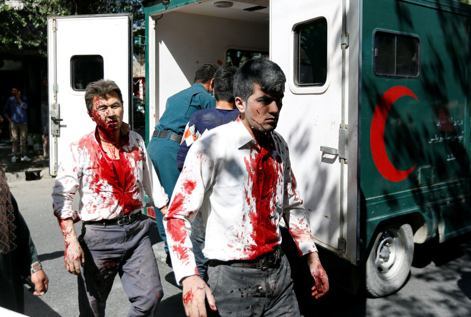 <p>Injured Afghan men arrive at a hospital after a blast in Kabul, Afghanistan May 31, 2017.(Mohammad Ismail/Reuters) </p>