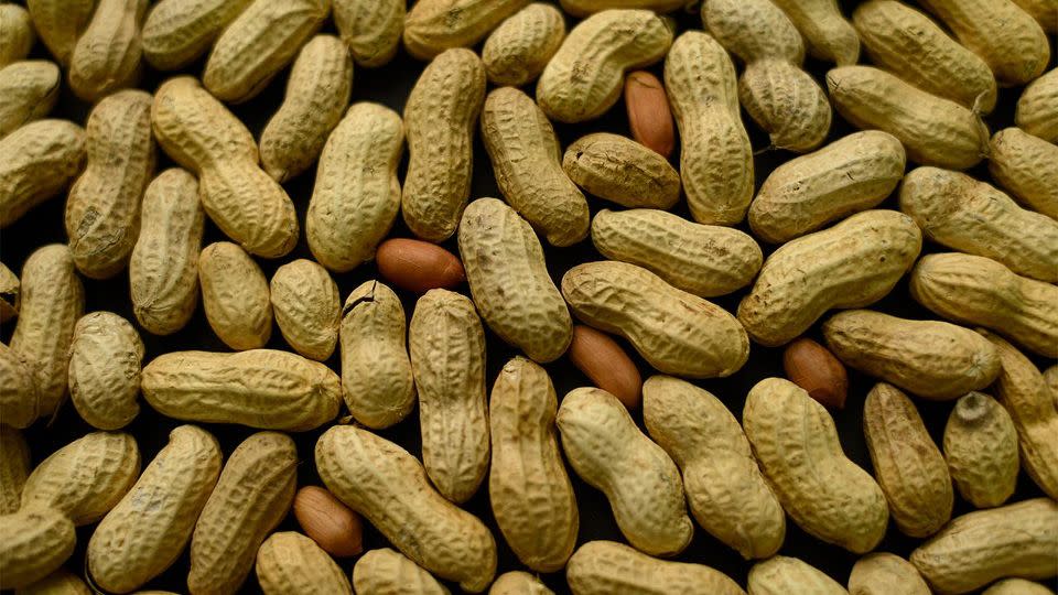 US teen Stone Cofini suffers from a peanut energy so severe he could die if he kisses someone who has eaten something cooked in peanut oil earlier that day. Photo: AP