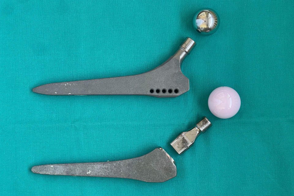 A monoblock artificial hip (top) is displayed next to a Profemur artificial hip implant to highlight the Profemur's additional junction between the dual modular neck and femoral stem. / Credit: Samo Fokter