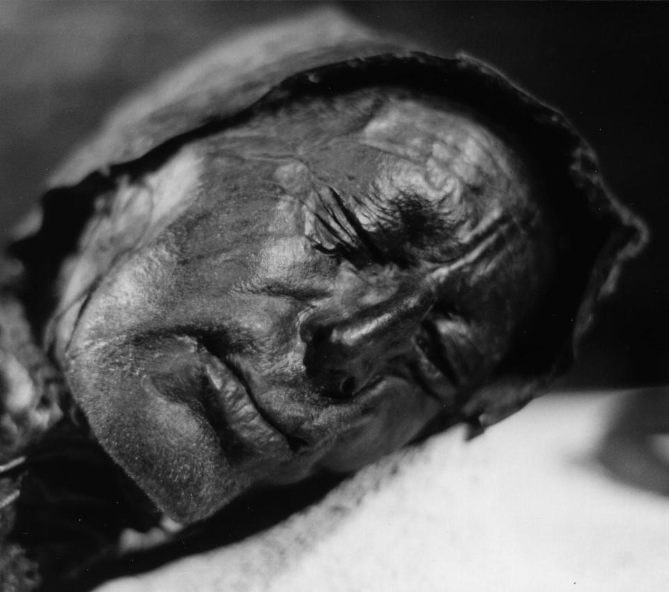 A head of a mummified person with eyes closed.