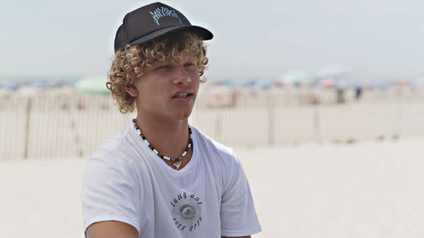 PHOTO: 'A shark bit Max Haynes on the foot while he was surfing off the coast of Long Island.' (ABC News)