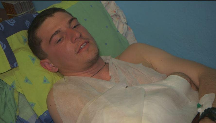 Nazik Hnativ, 27, was a radio host in Lviv before he volunteered to fight Russia's invading troops. With scant training and no experience, he was sent to the front lines in eastern Ukraine, where an artillery round left him with injuries to an arm and both legs on April 23, 2022. / Credit: CBS News