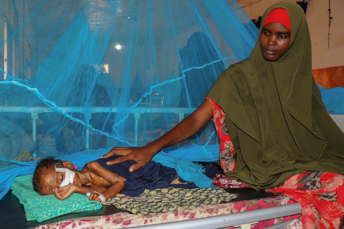 Dhahira Hassan Ali sits with her one-year-old son Adan as he is fed via a nasogastric feeding tube to treat his severe acute malnutrition, at the stabilization center of Bay Regional Hospital in Baidoa, Somalia (AP)