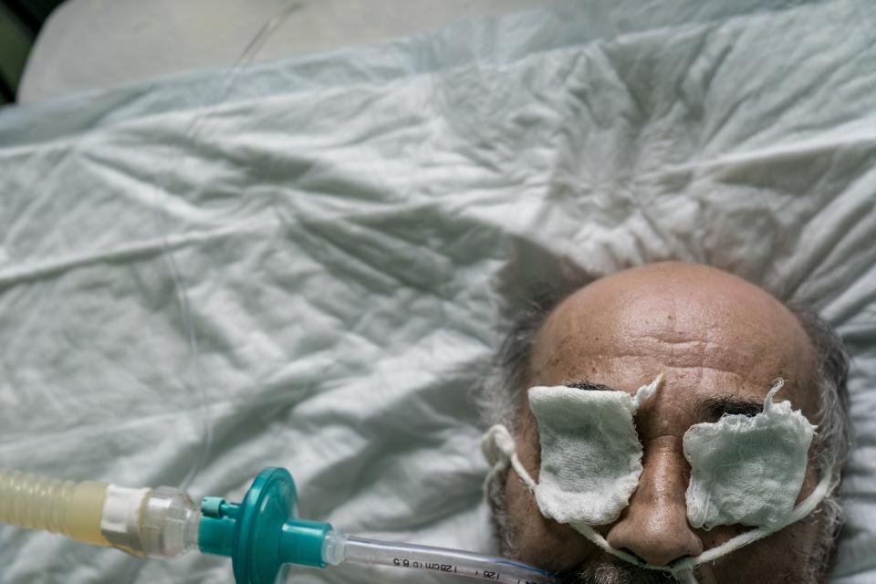 In this photo taken on Monday, May 4, 2020, a patient with coronavirus breathes with an oxygen mask at an intensive care unit at a regional hospital in Chernivtsi, Ukraine. Ukraine's troubled health care system has been overwhelmed by COVID-19, even though it has reported a relatively low number of cases. (AP Photo/Evgeniy Maloletka)