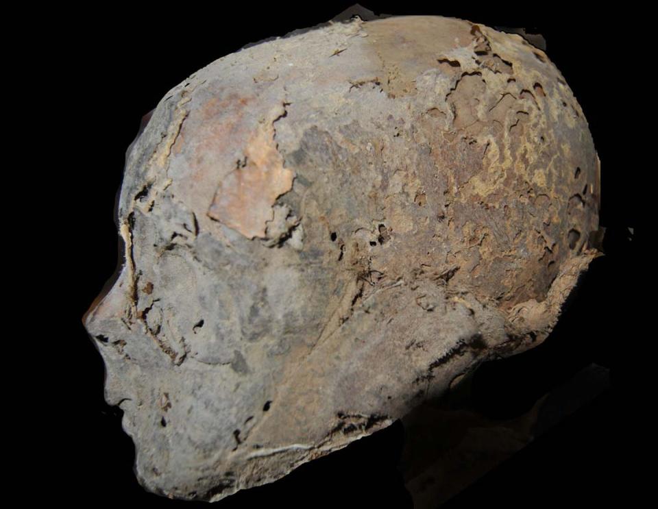 Cabeza momificada de doña Leonor de Castilla. <a href="https://www.researchgate.net/publication/353105462_Natural_mummifications_in_Castille_Leon_Spain" rel="nofollow noopener" target="_blank" data-ylk="slk:Pastor et al. 2021. Natural mummifications in Castile & Leon (Spain). European Journal of Anatomy 25: 221–32.;elm:context_link;itc:0;sec:content-canvas" class="link ">Pastor et al. 2021. Natural mummifications in Castile & Leon (Spain). European Journal of Anatomy 25: 221–32.</a>