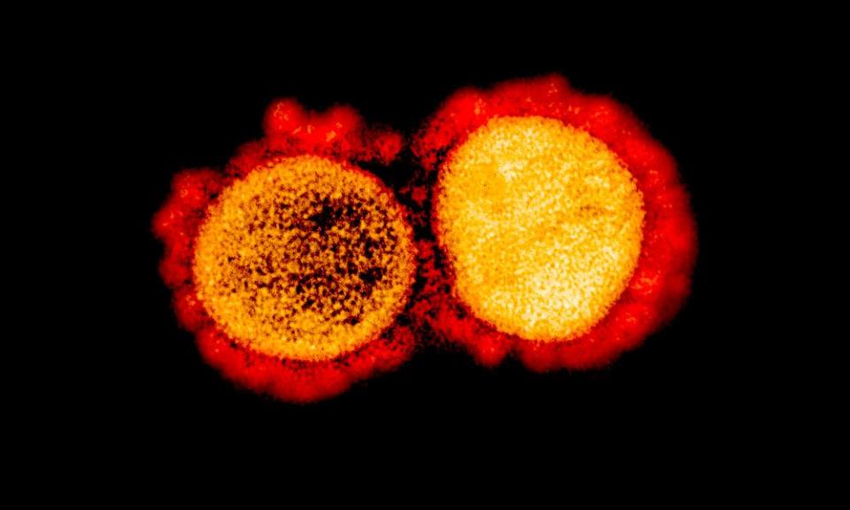 Image from National Institute of Allergy and Infectious Diseases shows a transmission of SARS-CoV-2 virus particles, isolated from a patient.