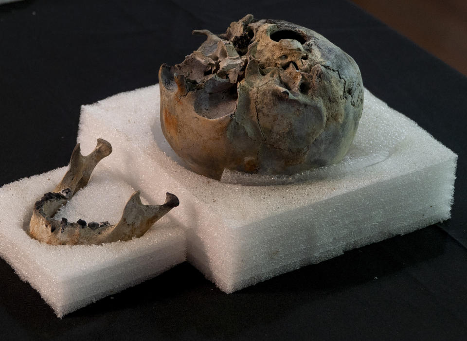 A mummy skull that was used for research purposes is presented to the media by the National Museum during a news conference in Rio de Janeiro, Brazil, Tuesday, May 7, 2019. Brazil's national museum said Tuesday it has recovered 200 pieces from its 700 pieces Egypt collection, the largest in Latin America, after a devastating fire in September 2018. (AP Photo/Lucas Dumphreys).