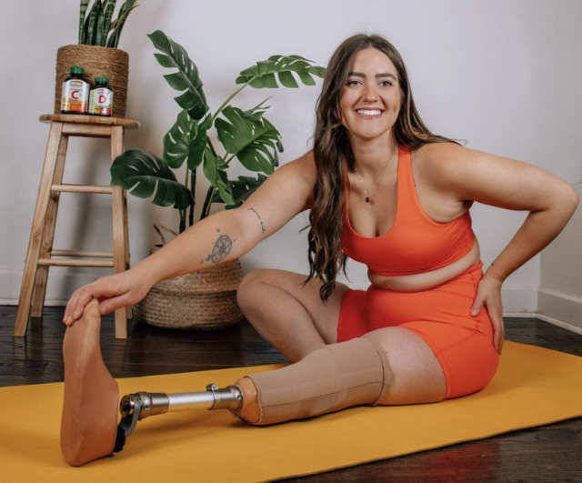 Smiling Young Woman With Prosthetic Leg Using Laptop In Living