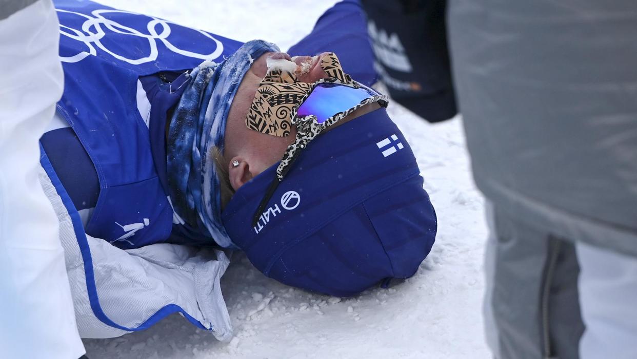 Remi Lindholm of Finland admitted to suffering a frozen penis after the shortened 50 km mass start race at the Beijing Olympics. (Credit: LEHTIKUVA / MARKKU ULANDER / GETTY IMAGES).