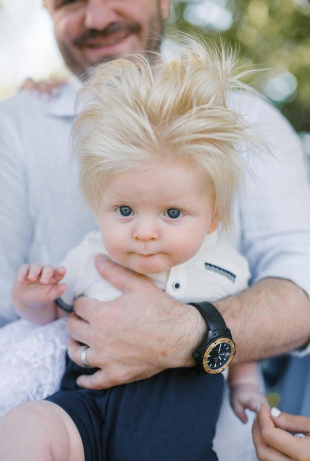 David Barabash was born with a full head of blonde hair.  (Courtesy Lysenko Euge)