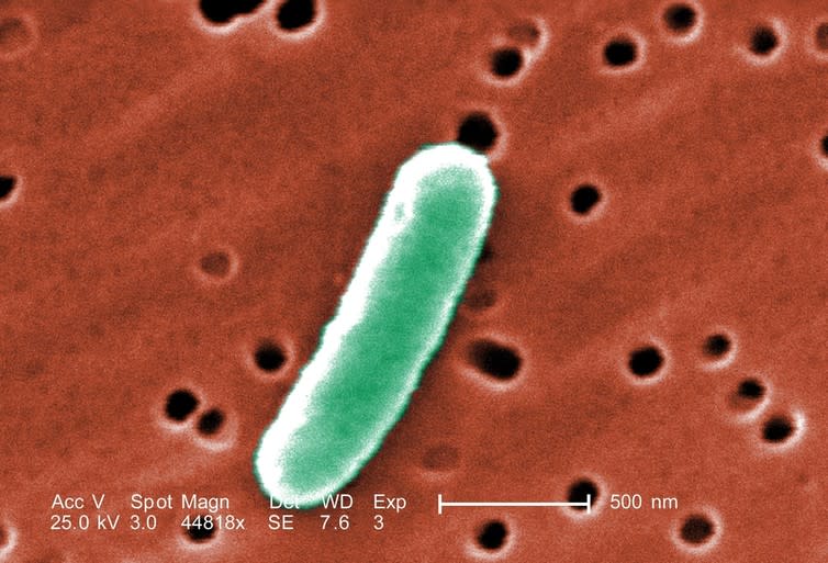 <span class="caption">An <em>E. coli</em> bacterium.</span> <span class="attribution"><a class="link " href="http://www.shutterstock.com/cat.mhtml?lang=en&language=en&ref_site=photo&search_source=search_form&version=llv1&anyorall=all&safesearch=1&use_local_boost=1&autocomplete_id=&searchterm=E.%20Coli&show_color_wheel=1&orient=&commercial_ok=&media_type=images&search_cat=&searchtermx=&photographer_name=&people_gender=&people_age=&people_ethnicity=&people_number=&color=&page=1&inline=242816092" rel="nofollow noopener" target="_blank" data-ylk="slk:Everett Historical/Shutterstock;elm:context_link;itc:0;sec:content-canvas">Everett Historical/Shutterstock</a></span>