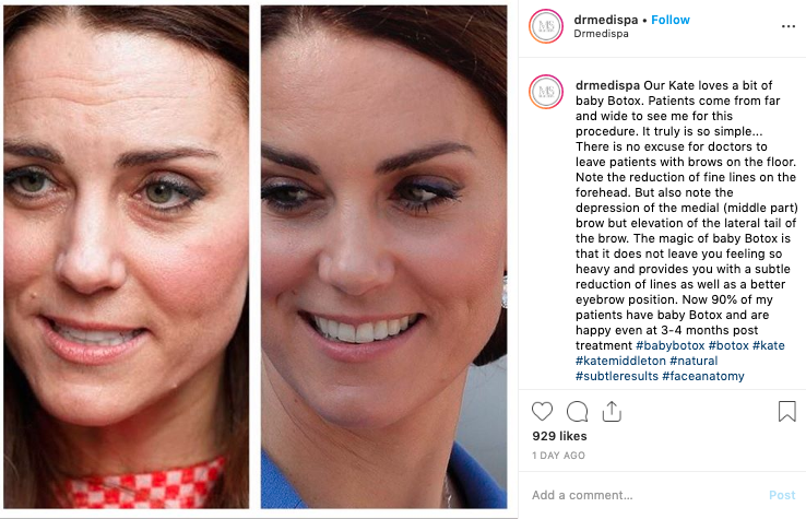 Side-by-side of Kate Middleton's face