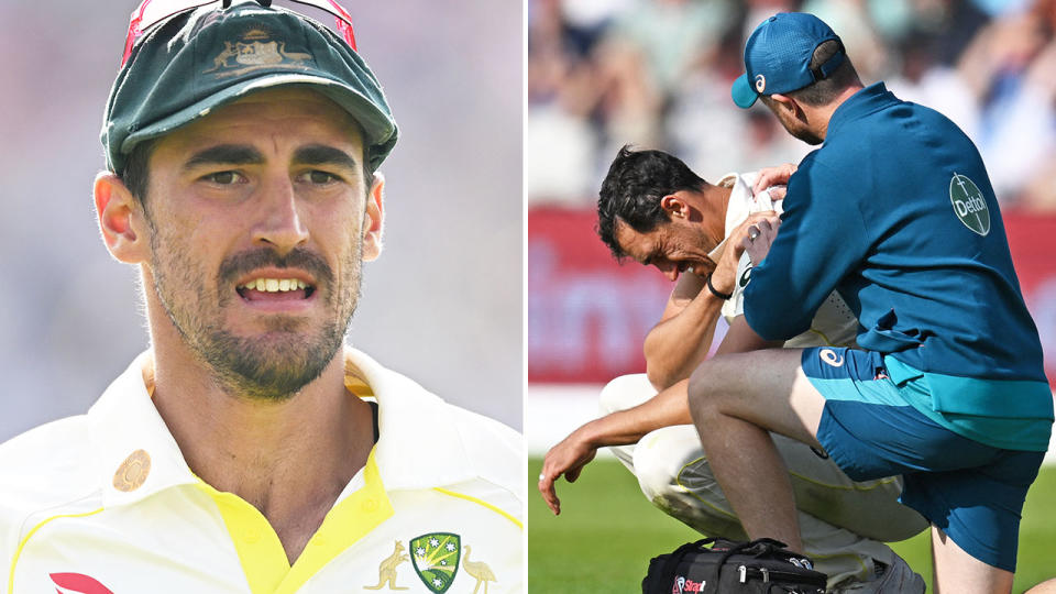 Seen here, Mitchell Starc is treated for an injured shoulder on day two of  the Ashes Test at Old Trafford.