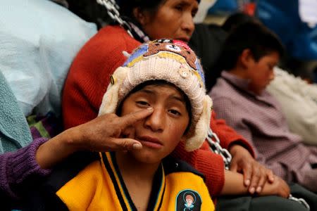 David Tolentino, a resident of the town Cerro de Pasco is seen with skin rash during protest for what they describe as rampant pollution from a sprawling polymetallic mine operated by Peruvian mining company Volcan, outside of the health ministry in Lima, Peru June 22, 2017. REUTERS/Mariana Bazo