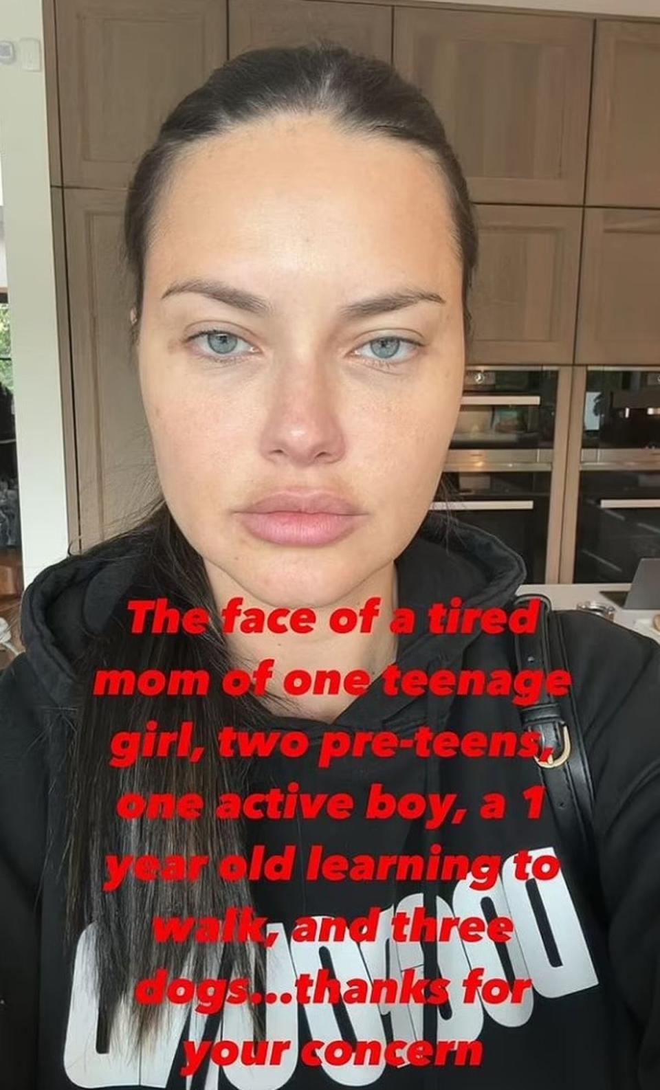 Lima took to her Instagram Story to address the furore (Instagram/Adriana Lima)