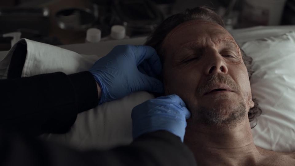 An unseen man with blue latex gloves uses a scalpel to cut another man's face